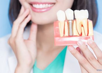 Zahnzusatzversicherung