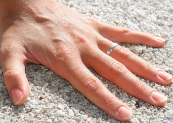 Frau trägt ein NFC Ring