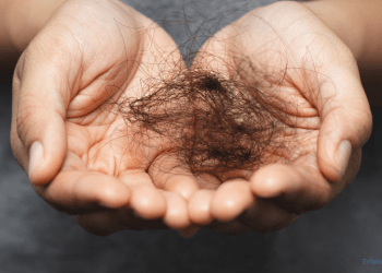 ausgefallenen Haaren