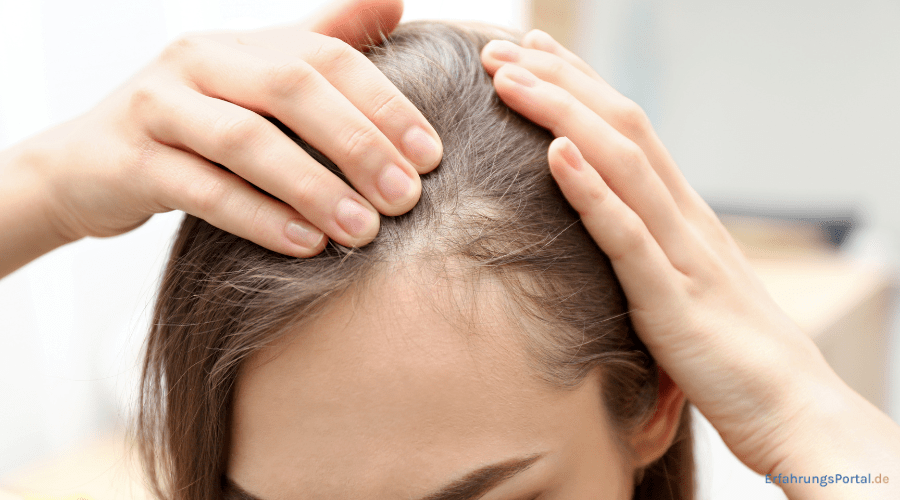 Haarausfall Frauen